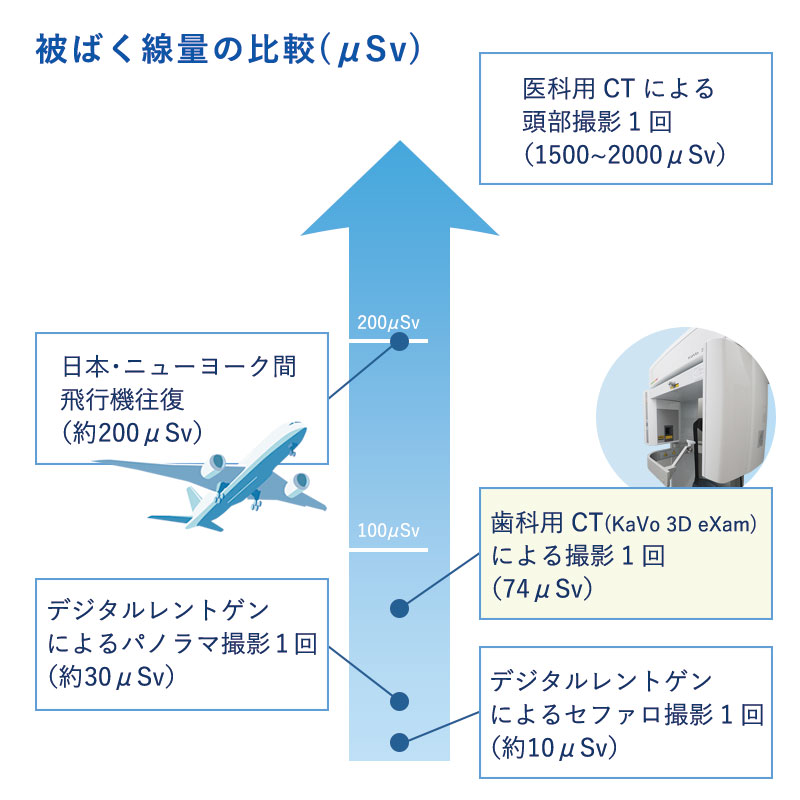 歯科用CTのコーンビーム方式