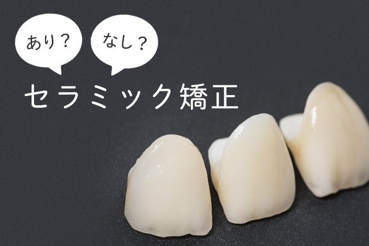 いい？悪い？セラミック矯正