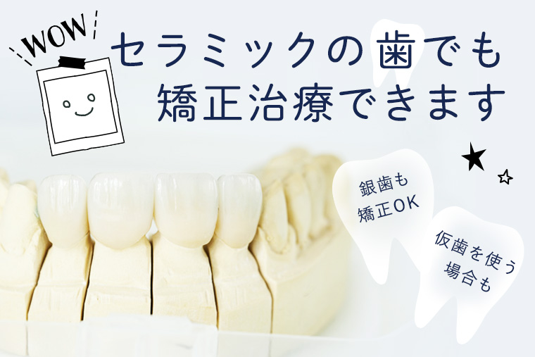 セラミックの歯があっても矯正できる？