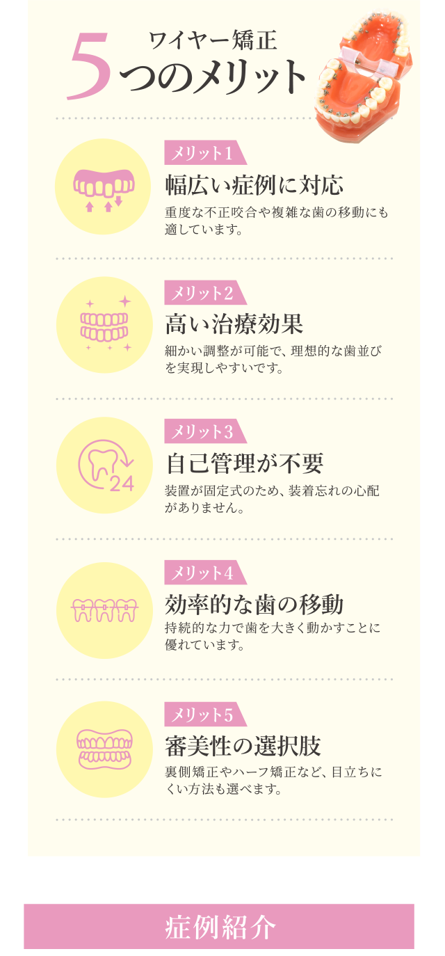 ワイヤー矯正の５つのメリット