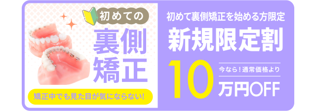 新規限定割