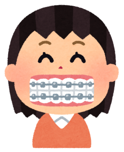 歯列矯正をする女性のイラスト