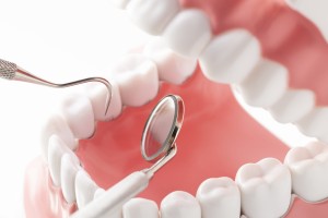 歯の模型と歯科用治療器具