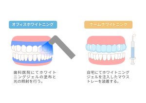 ホワイトニング　オフィスホワイトニング　ホームホワイトニング