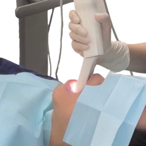 精密検査 3Dスキャナー