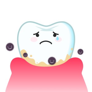 ガミースマイル　虫歯　歯周病