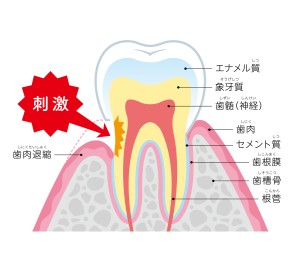 歯肉退縮　原因