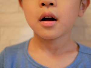 口呼吸