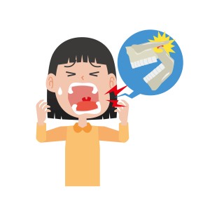 顎関節症
