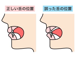 舌の位置