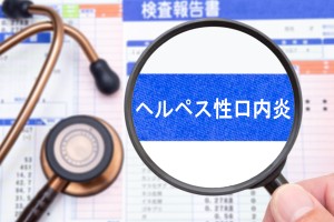 ヘルペス性歯肉口内炎