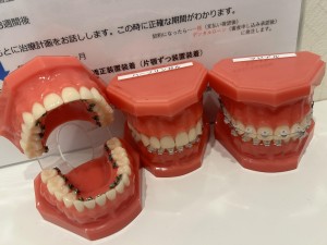 渋谷矯正歯科　カウンセリング
