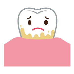 歯　歯石　くさい　歯周病