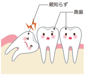 親知らず　抜歯　渋谷矯正歯科