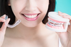 マウスピースとワイヤー矯正の模型を持つ女性