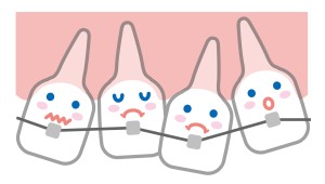 ガタガタ歯並びの歯列矯正のイラスト