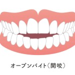 オープンバイトのイラスト