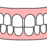 渋谷矯正歯科　すきっ歯