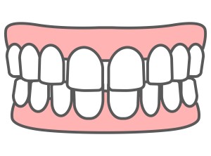 渋谷矯正歯科 すきっ歯