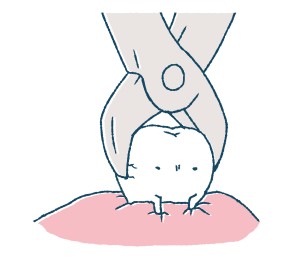 非抜歯のイメージイラスト