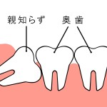 倒れる親知らずのイラスト