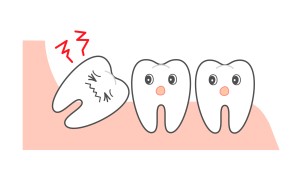 親知らずのイラスト