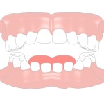矮小歯のイラスト
