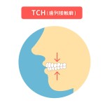 歯列接触癖（TCH）のイラスト