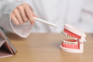 矯正装置の模型で説明する歯科医師