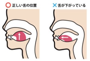 舌の位置　イラスト