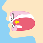舌壁　イラスト