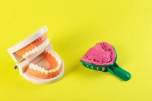 渋谷矯正歯科 印象 歯の型取り